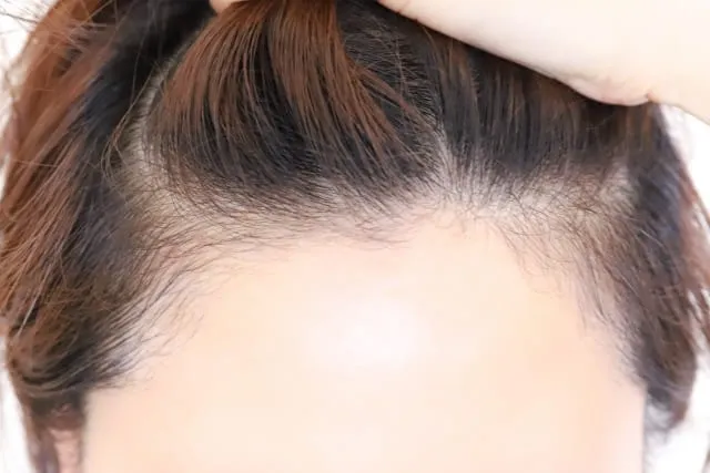 おでこが広い男性に似合うメンズパーマとは？コンプレックスを魅力に変える方法